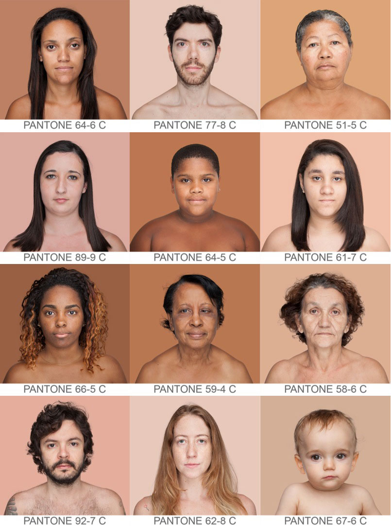 Como sanar las anguillas vulgares sobre la persona