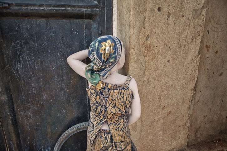 albino-culturainquieta11-2