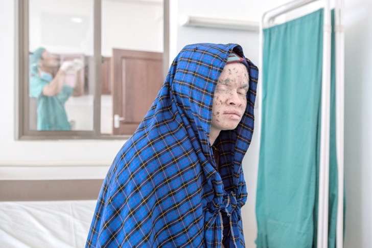 albino-culturainquieta12-2