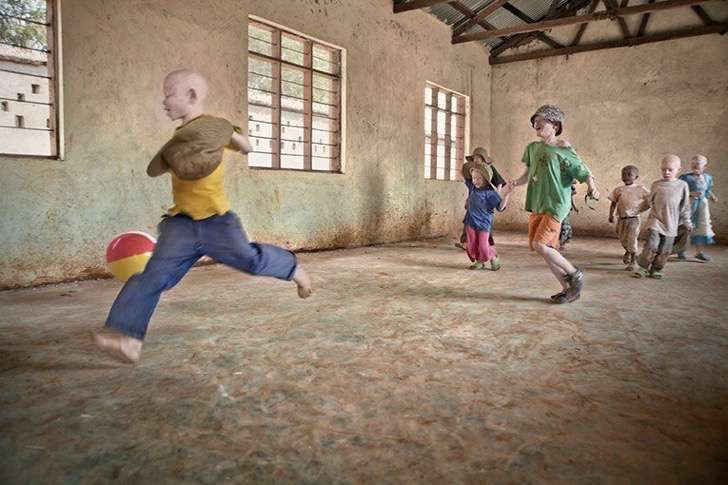 albino-culturainquieta7-2