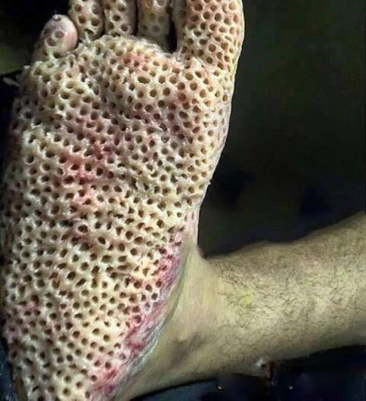 Imagenes Asquerosas De Tripofobia | las nuevas im 225 genes de american horror story hacen Imagenes Asquerosas De Tripofobia | las nuevas im 225 genes de american horror story hacen