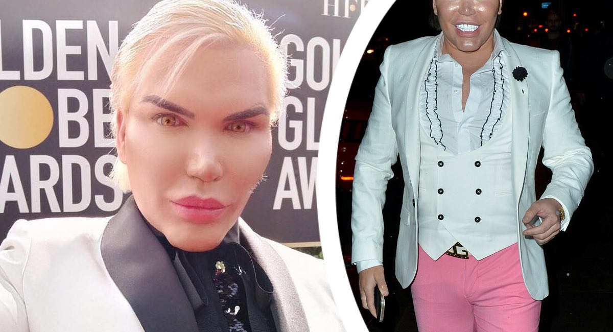 Rodrigo Alves tiñe su pelo luego de humillación en Globos de Oro. Es su forma de pedir perdón