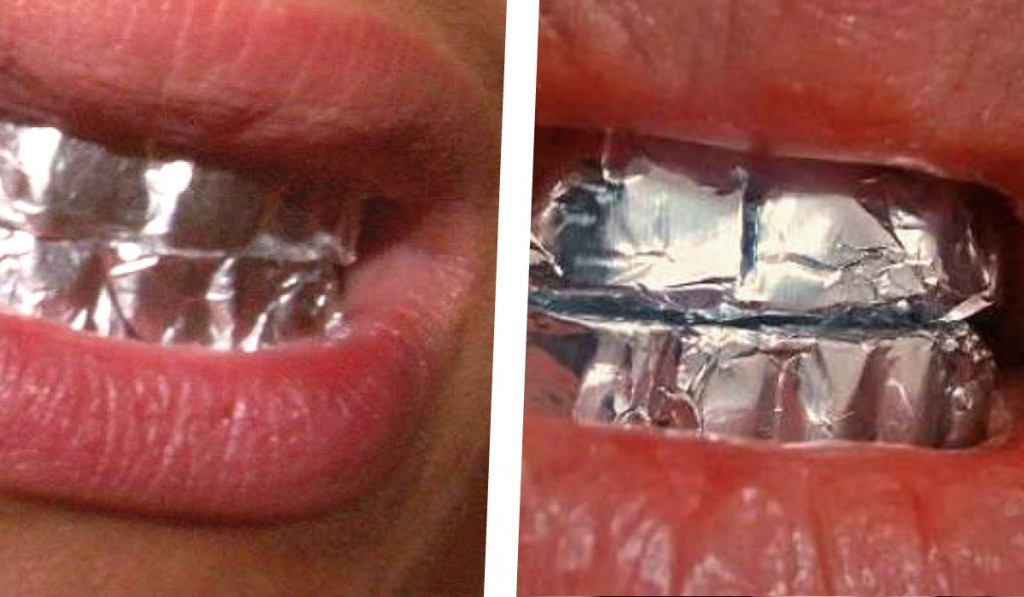 como hacer pregnancy aclarar los dientes rapido