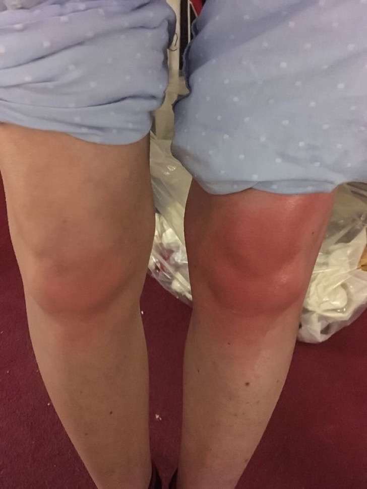porque se me inflama la rodilla y me duele