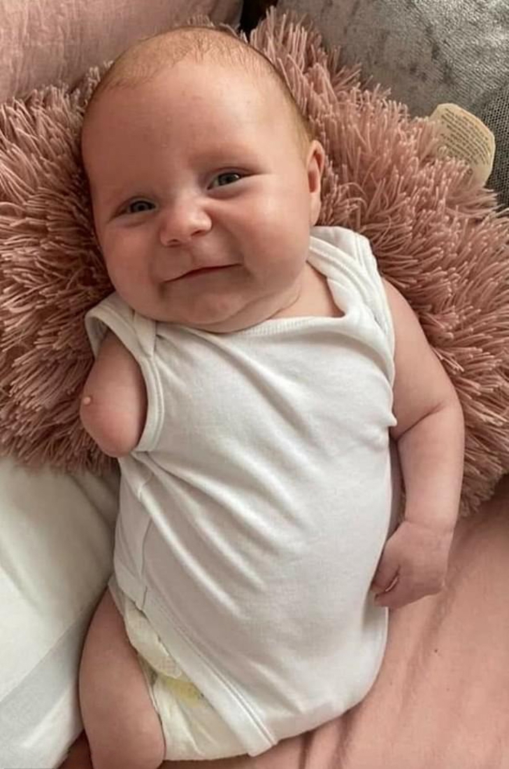Madre decidió dar a luz a su bebé sabiendo que vendría sin piernas y un brazo: “Para mí es perfecto” | Upsocl